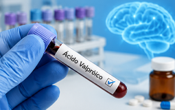 Ácido Valpróico