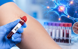 Vitamina B12